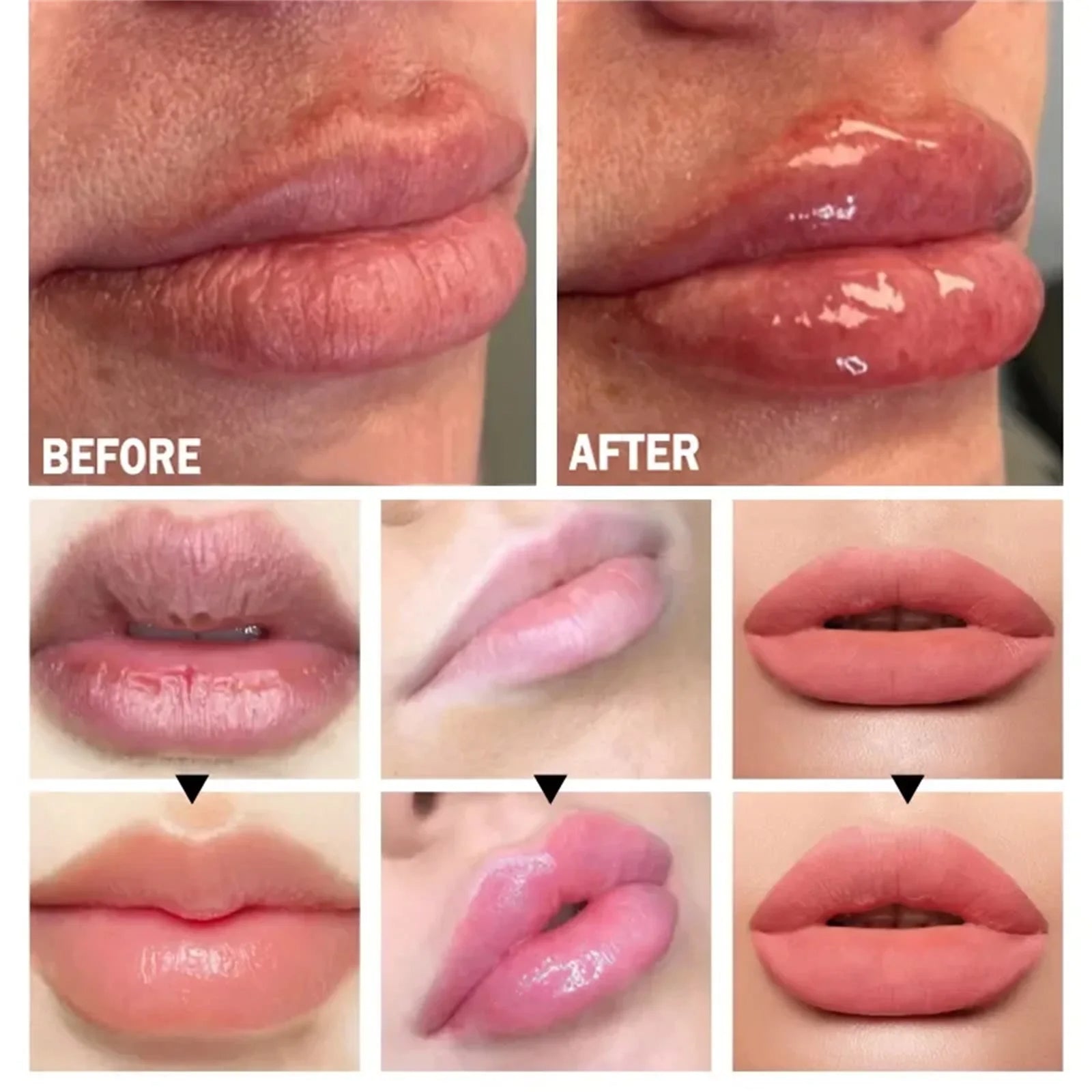Gloss com Preenchimento e Hidratante Labial Honey Pump Derol