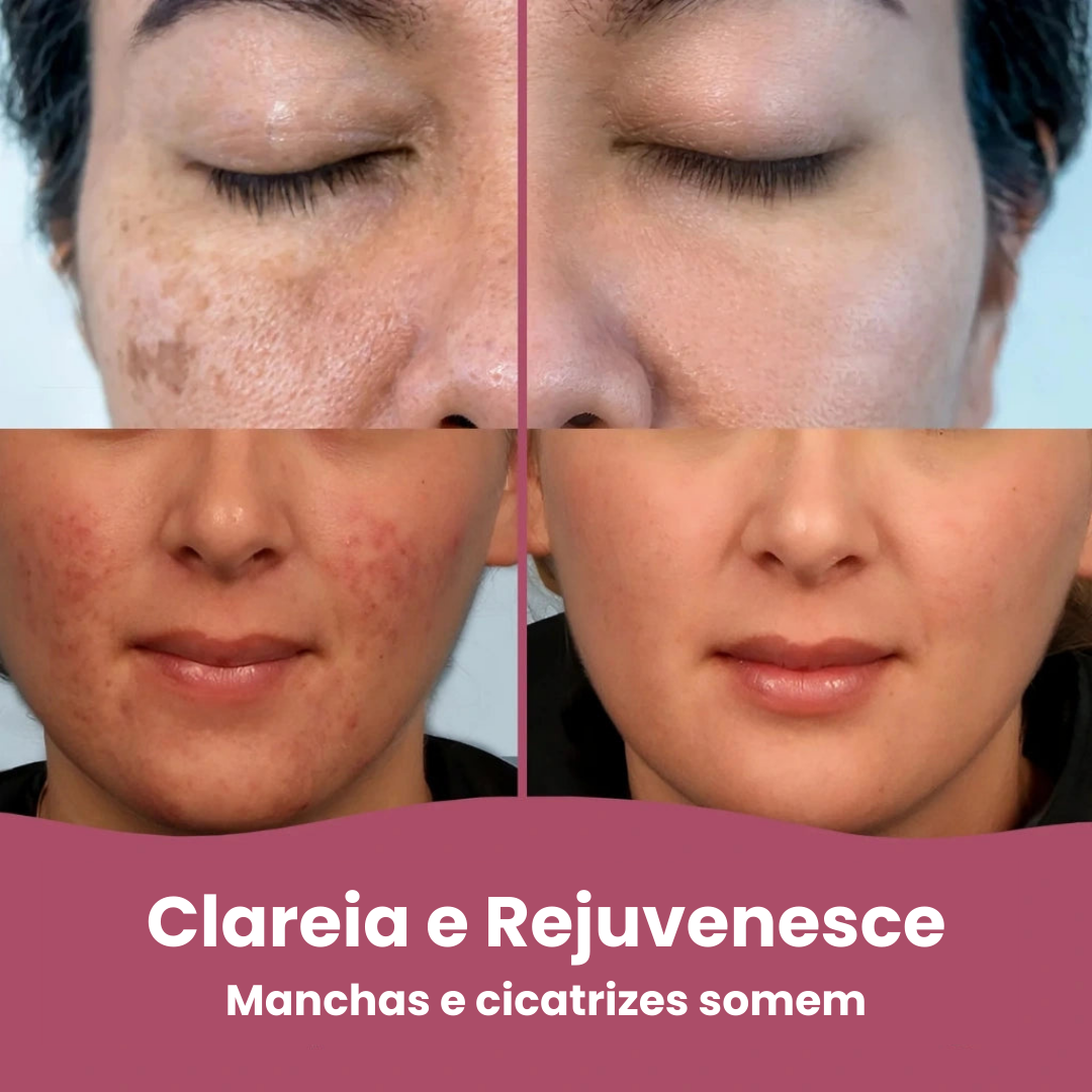 Combo Revitalizador de Açafrão - COMPRE 1, LEVE 2 + BRINDE EXCLUSIVO