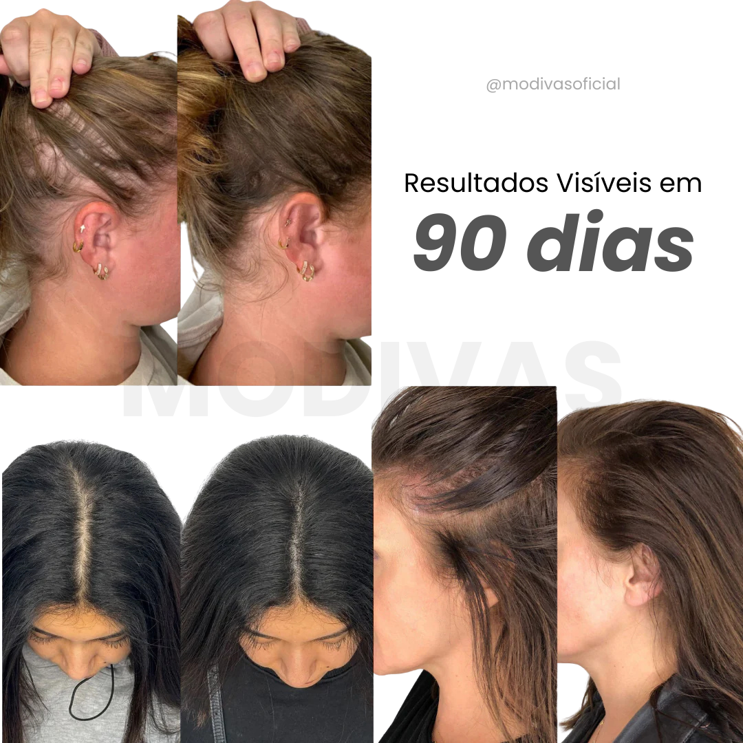 Escova Thera Brush™ 4 em 1 Terapia Capilar + BRINDE EXCLUSIVO