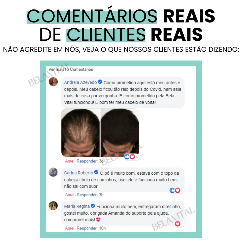 Sevich Hair: Pó de Maquiagem para Cabelo com Cobertura Natural