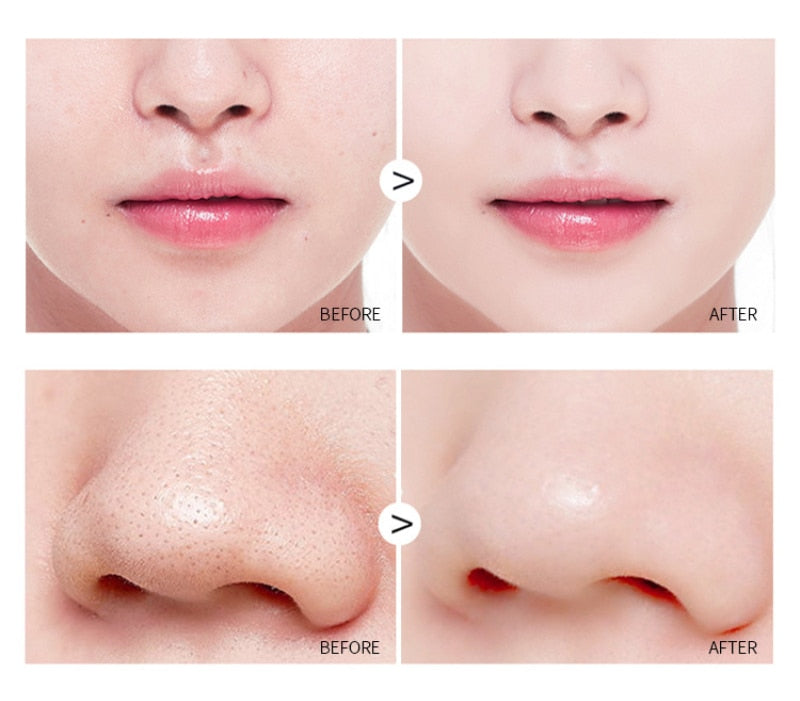 Máscara Removedora de Cravos Controle de Oleosidade